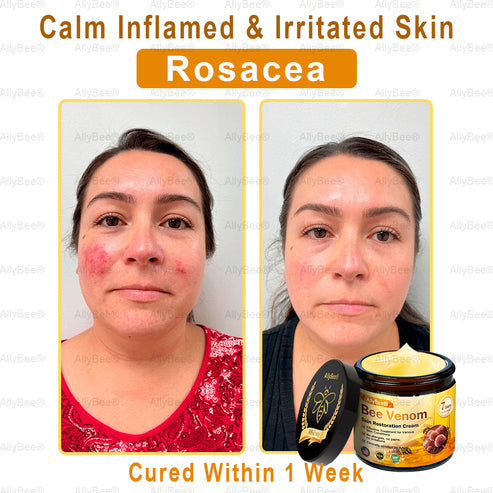 BEE VENOM SKIN CREAM (Copy)